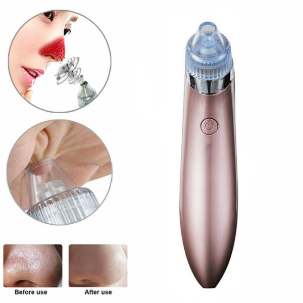 Electric Blackhead Vacuum Pore Cleaner Acne Pimple Remover Strong Suction Tool Electric Blackhead Remover Pore Vacuum Suction Diamond Dermabrasion Face Cleaner - Image 9